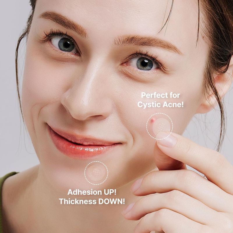 Acropass Acne Cure DEN Microarray Patch (4ct), Korean Beauty