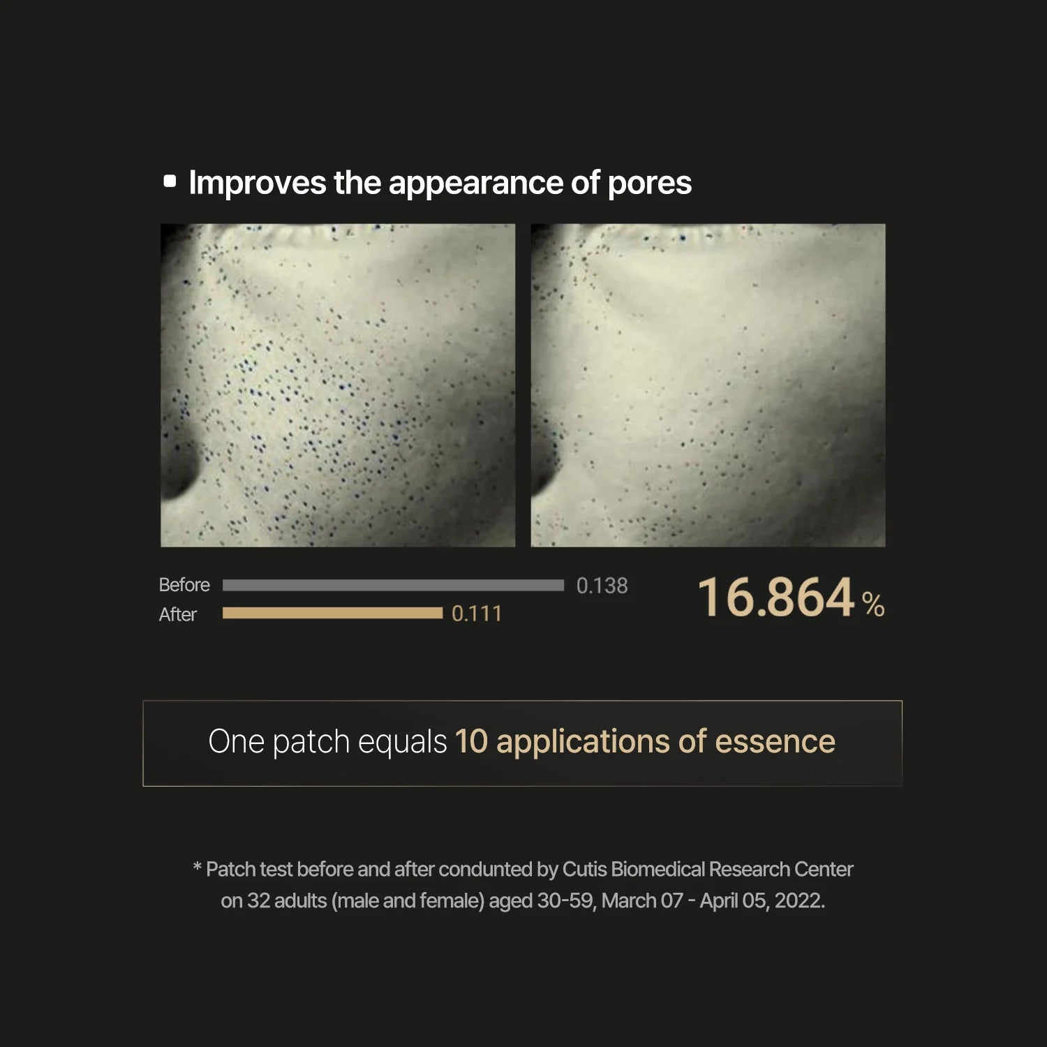 Acropass Retinol Microcone Slim Patch, Korean Beauty