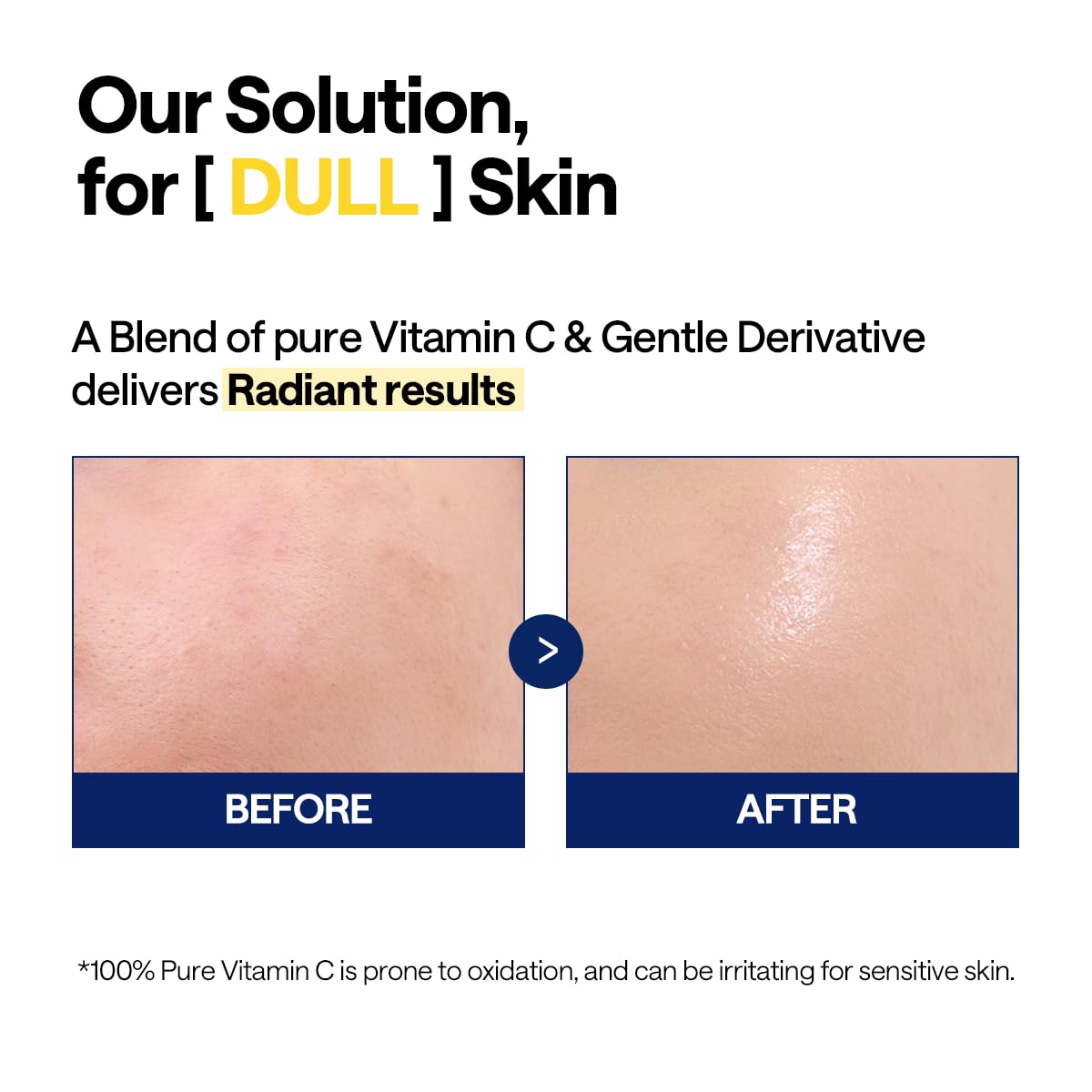 MEDIHEAL Vitamin C Brightening Serum, 1.35 fl. oz., Korean Beauty