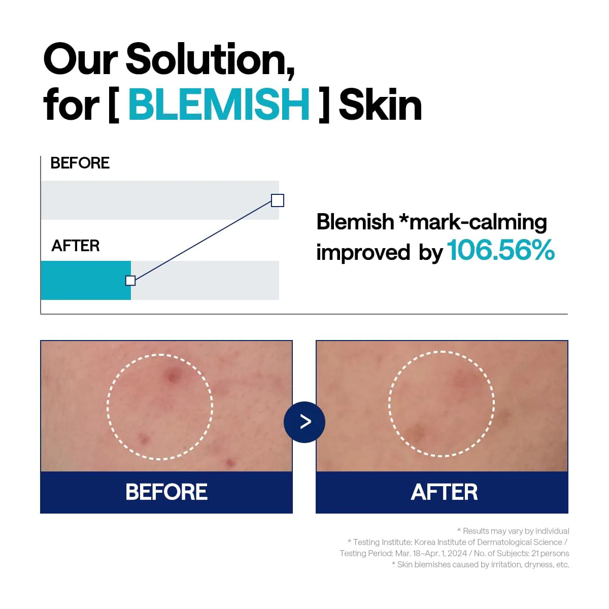 MEDIHEAL Madecassoside Blemish Repair Serum, Korean Beauty